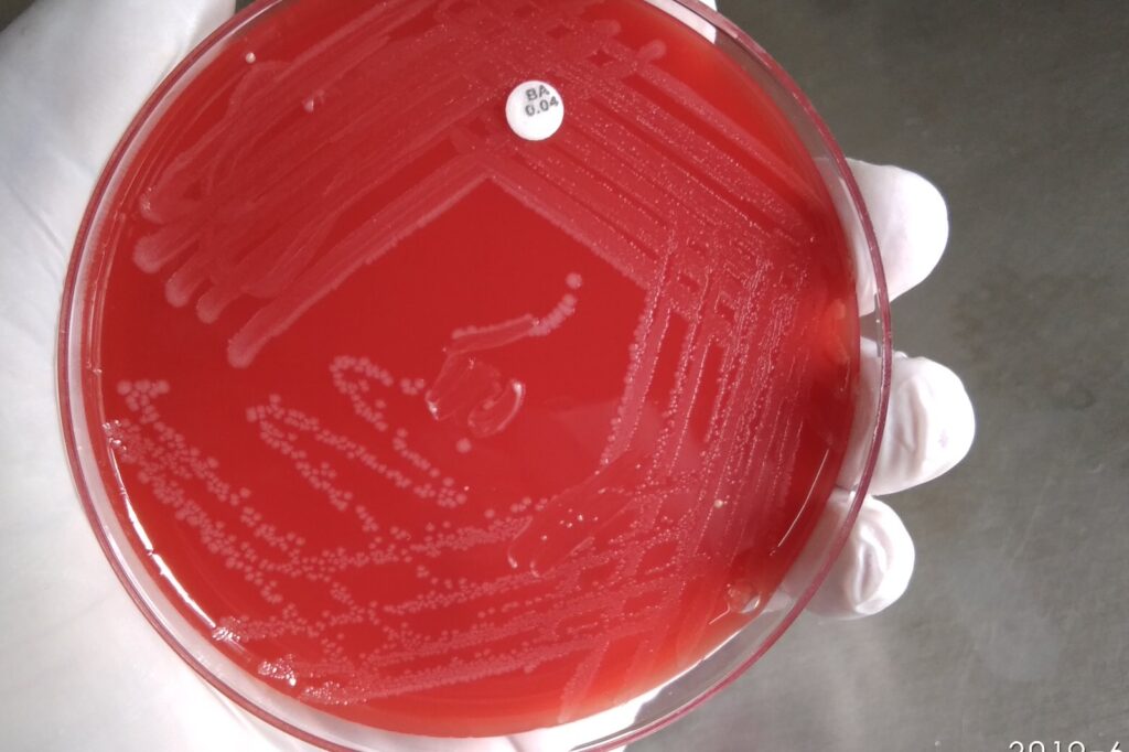 Listeria’s Cold Survival Makes Home Sanitization Critical After Meat Recalls
