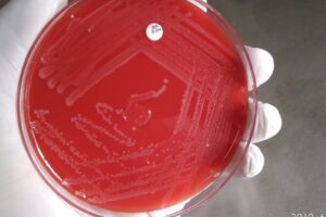 Listeria’s Cold Survival Makes Home Sanitization Critical After Meat Recalls